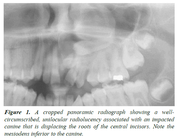 oral-medicine-toxicology-panoramic-radiograph