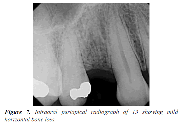 oral-medicine-toxicology-periapical-radiograph