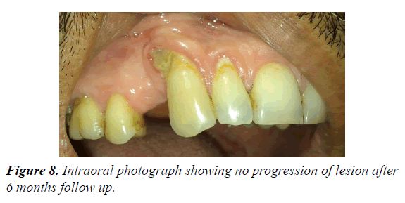 oral-medicine-toxicology-progression-lesion