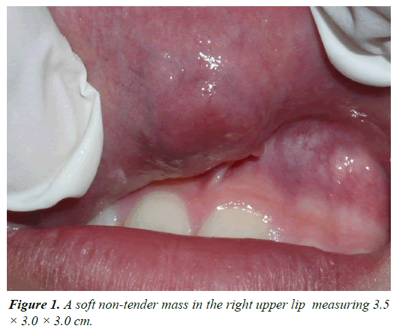 oral-medicine-toxicology-upper-lip