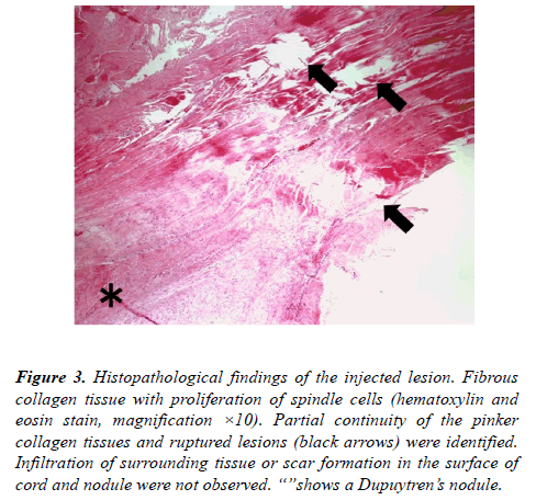 orthopedic-surgery-rehabilitation-Histopathological-findings