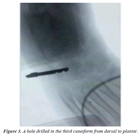 orthopedic-surgery-rehabilitation-dorsal-plantar