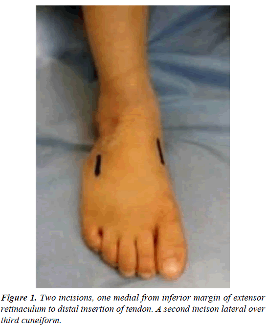 orthopedic-surgery-rehabilitation-medial-inferior-margin