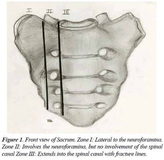 orthopedic-surgery-rehabilitation-neuroforamina