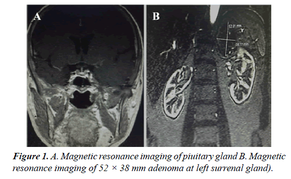 orthopedic-surgery-rehabilitation-resonance-imaging