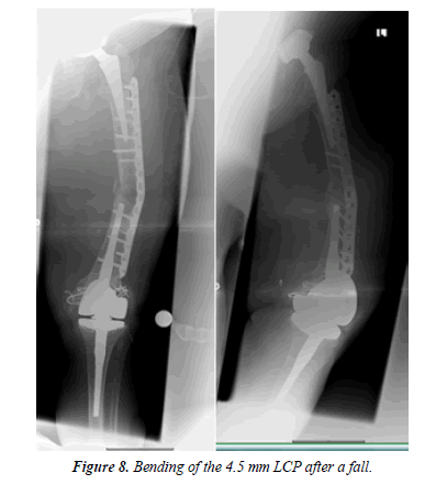 orthopedic-surgery-rehabilitation-segmentary-bending