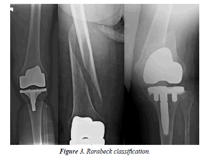 orthopedic-surgery-rehabilitation-segmentary-classification