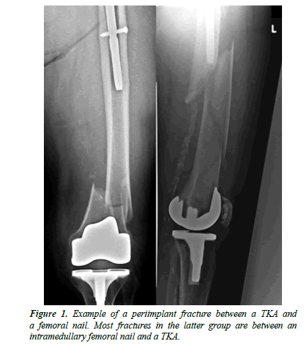 orthopedic-surgery-rehabilitation-segmentary-periimplant