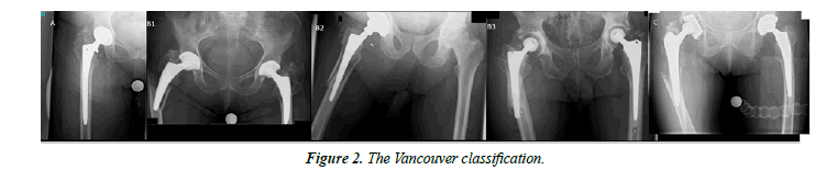 orthopedic-surgery-rehabilitation-segmentary-vancouver