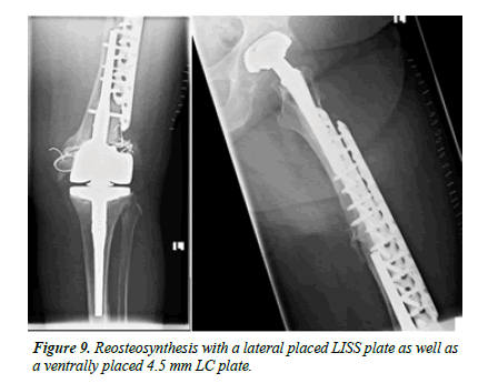 orthopedic-surgery-rehabilitation-segmentary-ventrally