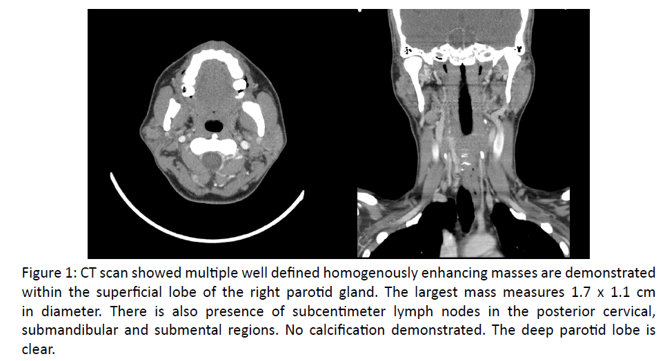 otolaryngology-CT-scan-showed