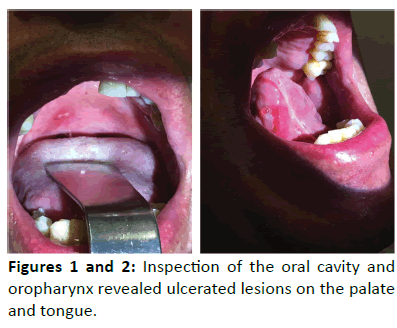 otolaryngology-online-journal-