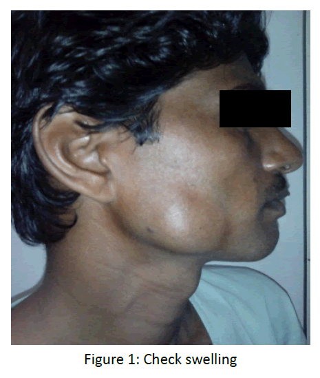 otolaryngology-online-journal-Check-swelling