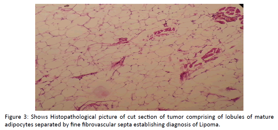 otolaryngology-online-journal-Histopathological