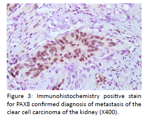 otolaryngology-online-journal-Immunohistochemistry