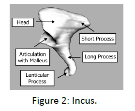 otolaryngology-online-journal-Incus