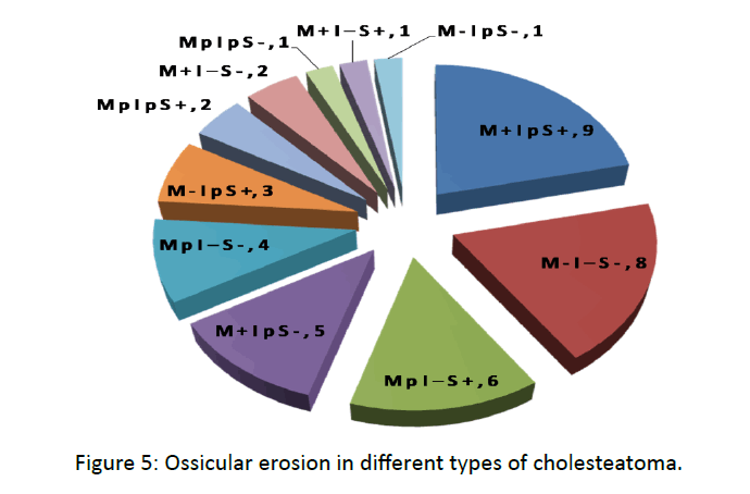 otolaryngology-online-journal-Ossicular-erosion