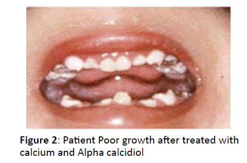 otolaryngology-online-journal-Patient-Poor-growth