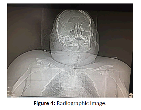 otolaryngology-online-journal-Radiographic-image