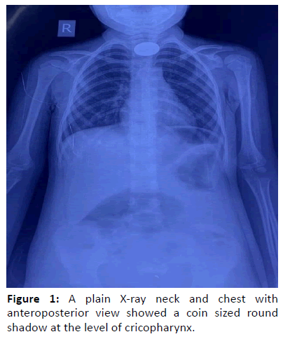 otolaryngology-online-journal-anteroposterior