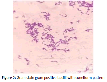 otolaryngology-online-journal-bacilli