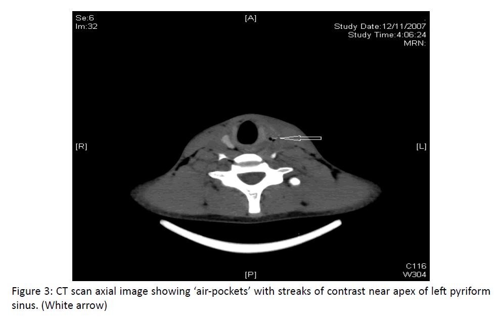 otolaryngology-online-journal-contrast-near-apex