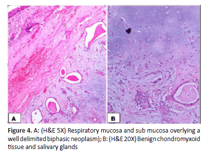 otolaryngology-online-journal-mucosa