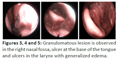 otolaryngology-online-journal-observed