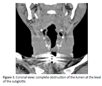 otolaryngology-online-journal-obstruction