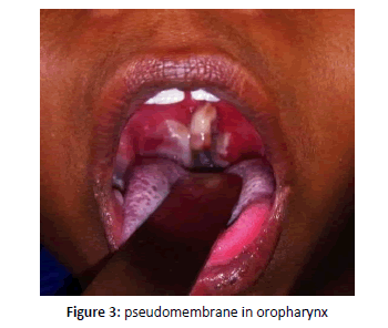 otolaryngology-online-journal-oropharynx