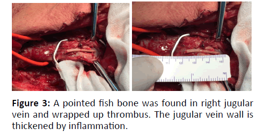 otolaryngology-online-journal-pointed-fish