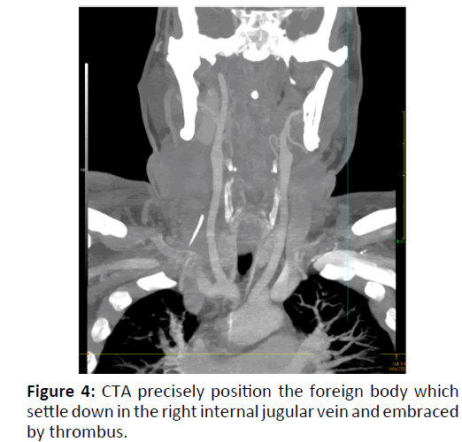 otolaryngology-online-journal-precisely-position