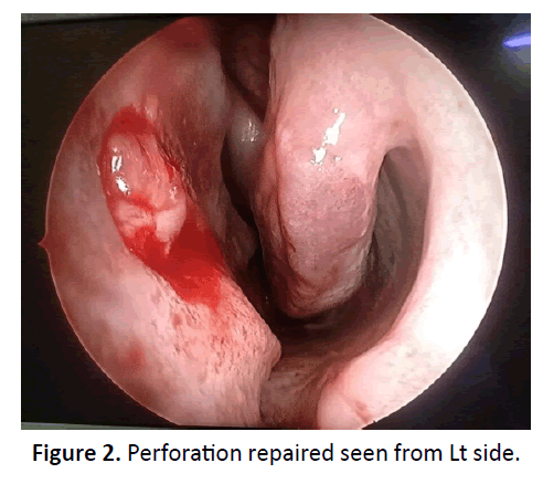 otolaryngology-online-journal-repaired