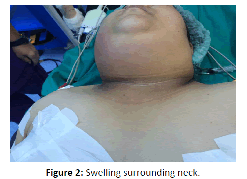 otolaryngology-online-journal-surrounding-neck