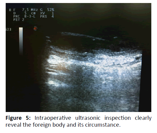 otolaryngology-online-journal-ultrasonic-inspection