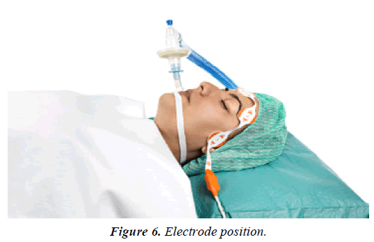 pain-management-and-therapy-Electrode-position