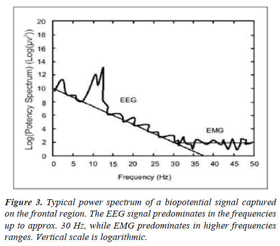 pain-management-and-therapy-Typical-power-spectrum