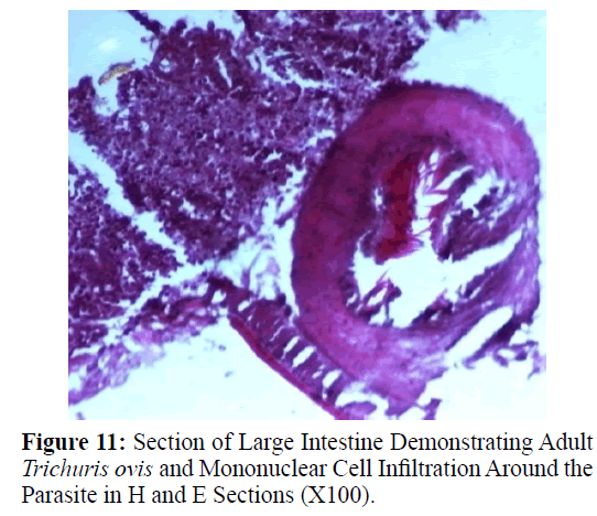 parasitic-diseases-diagnosis-Adult-Cell