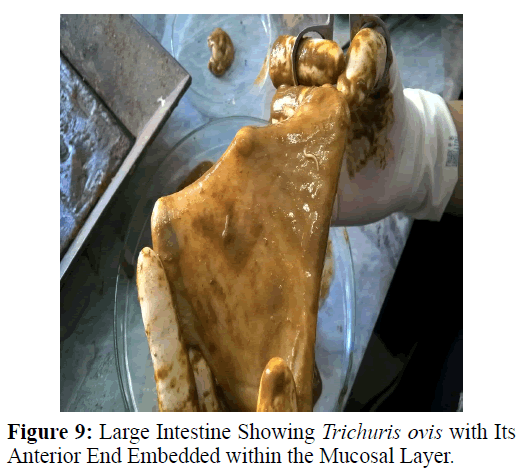 parasitic-diseases-diagnosis-Anterior-Mucosal