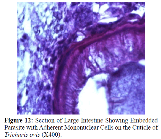 parasitic-diseases-diagnosis-Cuticle-Cells