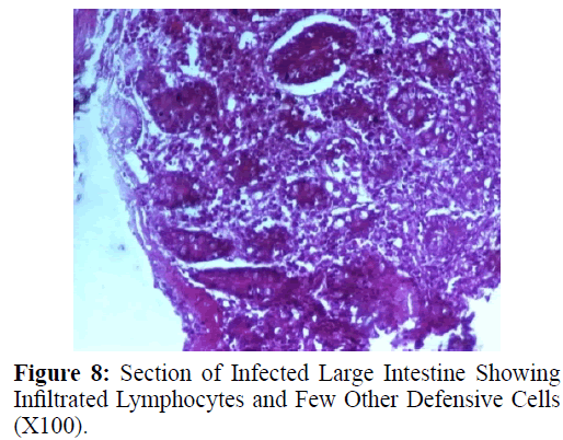 parasitic-diseases-diagnosis-Defensive-Cells