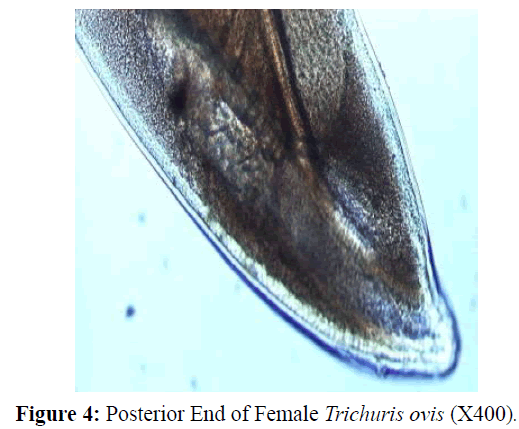 parasitic-diseases-diagnosis-Female-Posterior