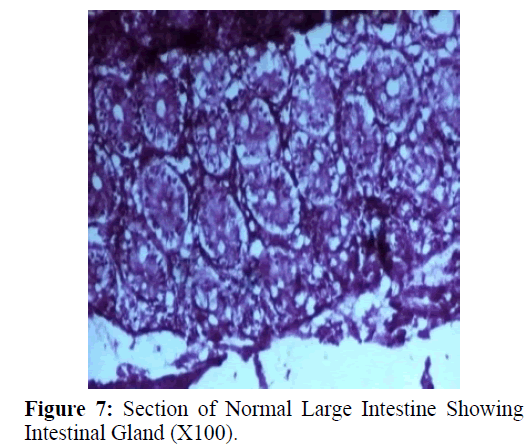 parasitic-diseases-diagnosis-Intestinal-Gland