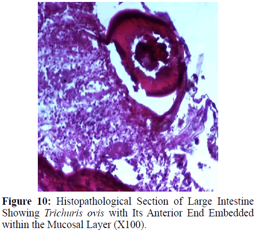 parasitic-diseases-diagnosis-Large-End