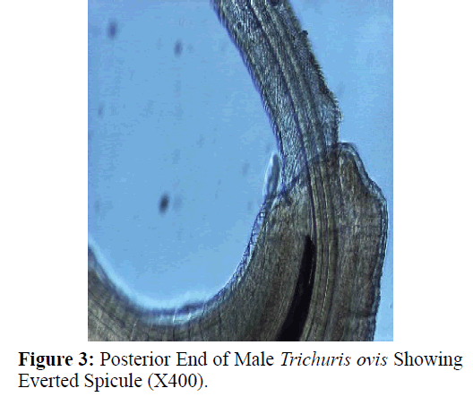 parasitic-diseases-diagnosis-Male-Posterior