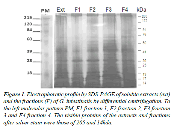 parasitic-diseases-diagnosis-therapy-Electrophoretic-profile