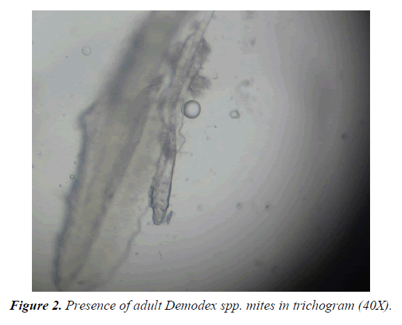 parasitic-diseases-diagnosis-therapy-mites-trichogram