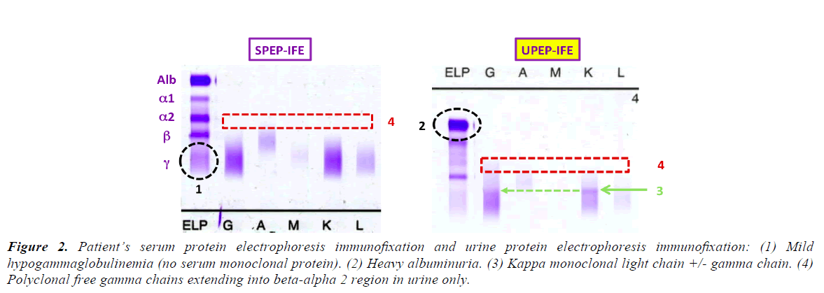 pathology-disease-biology-gamma-chains