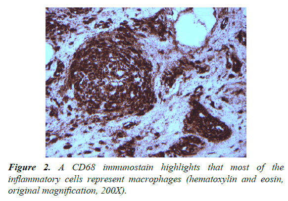 pathology-disease-biology-inflammatory-cells