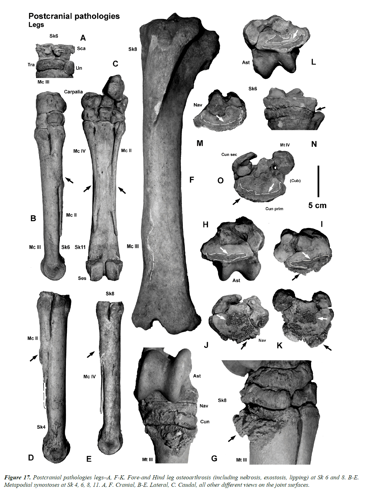 pathology-disease-biology-leg-osteoarthrosis